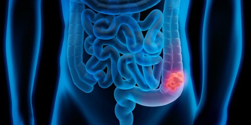 Article du 1er avril 2025